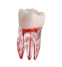 Root Canals